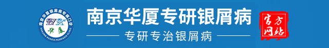 南京华厦银屑病